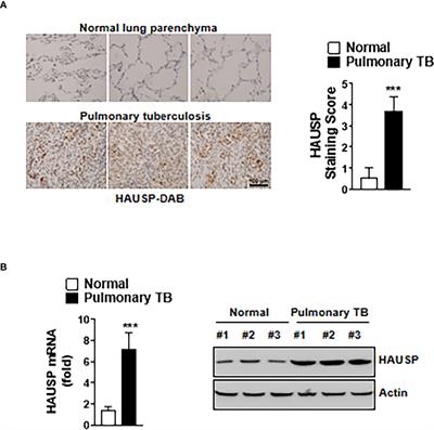 PE_PGRS38 Interaction With HAUSP Downregulates Antimycobacterial Host Defense via TRAF6